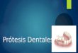 Prótesis dentales 1