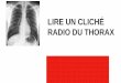 Exercice radio thorax