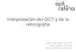 Interpretación del OCT y de la retinografía - · PDF fileTomografia de coherencia óptica . Gracias . rekÎnQ . rekÎnQ . Title: Interpretación del OCT y de la retinografía Author: