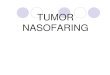 TUMOR PD THT.ppt [Read-Only] - ocw.usu.ac.idocw.usu.ac.id/.../sss155_slide_tumor_nasofaring.pdf · Klasifikasi Karsinoma Nasofaring Menurut WHO TIPE KERATINIZING ... Goepfert menyarankan