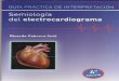 Semiologia del electrocardiograma. Ricardo Cabrera Solé · PDF fileSemiologia del electrocardiograma. Ricardo Cabrera Solé