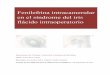 Fenilefrina intracamerular en el síndrome del iris flácido ... · PDF fileLa mayoría de medicación usada fue la Tamsulosina en el grupo de casos ( 27 /29 ) y la edad media fue