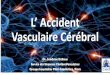 L’ Accident -  · PDF fileCardioembolique ACFA ds 50% des cas Maladies des petites artères Lipohyalinose des petites artères/Lacune Classification TOAST: