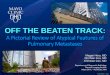 Off the Beaten Track: A Pictorial Review of Atypical …eposterkiosk.com/wcti17/ePosters/EEE-02-02-Hora.pdf©2016 MFMER | slide-3 • Extrathoracic malignancies have a marked predilection