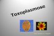 Agente etiológico: Toxoplasma gondii€¦ · Toxoplasmose congênita Somente durante a fase aguda de infecção da infecção materna os parasitas são passados para o feto. Das