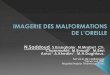 IMAGERIE DES MALFORMATIONS DE L’OREILLEpe.sfrnet.org/Data/ModuleConsultationPoster/pdf/2011/1/90adcfdf... · Souvent associées à une anomalie du CAE, de l'oreille moyenne , plus