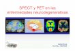 SPECT y PET en las enfermedades neurodegenerativas · spect tipo imagen pet 99mtc-hmpao perfusiÓn 15o-h2o 99mtc-ecd 99mtc-ecd metabolismo 18f-fdg 123i-ioflupano transportadores dopamina