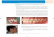 Cómo diferenciar una mordida cruzada dental de una …media.axon.es/pdf/115877_5.pdfCapítulo 6: Soluciones prácticas para la corrección de una mordida cruzada 221 Cómo diferenciar