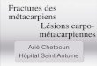 Fractures des m tacarpiens L sions carpo- m tacarpiennes · Fractures du col du m tacarpien •Fractures articulaires:-Rare. - Décollements épiphysaires, avulsions ligamentaires,