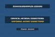 Presentazione di PowerPoint - Lezioni gratuite di … · Cervical arterial dissections: vertebral artery dissections. ... or absence of flow with no spectral Doppler waveform) are