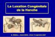 La Luxation Congé nitale Hanche - college-chirped.fr · Embryologie • 5- 6 sem : pi èl ’ iliaque • 8 sem : Cavité articulaire • 11 sem : vascularisécouverte hyalin •
