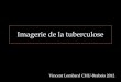 Imagerie de la tuberculose - onclepaul.netonclepaul.net/wp-content/uploads/2011/07/imagerie-de-la-tuberculos.pdf · foyer inflammatoire chronique fibreux. • Défenses immunitaires