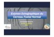 Echo Cerveau normal - Site du CPDPN Strasbourg … Cerveau normal.pdf · A1 Deux plans axiaux permettent de visualiser les structures céré brales pertinentes pour évaluer l'intégrité