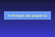 Pathologie des paupières - dcem1p7.free.frdcem1p7.free.fr/Ophtalmo/cours2.pdf · le bord libre, rosée, parfois hyperkératosique. Verrue séborrhéique (dite sénile) : ... •plus