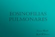 EOSINOFILIAS PULMONARES - areasaludbadajoz.com · Etiología: 2/3 parecen relacionarse con parásitos (Ascaris ... (suele haber rinitis, sinusitis, pólipos nasales o asma). Compromiso