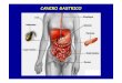 Cancro gastrico - Fisiokinesiterapia – Portale di … gastrico.pdf · - bcl-2 c-myc k-sam nm 23 CONDIZIONE PRECANCEROSA “Stato” della mucosa che ha maggiori possibilità del