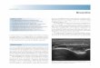 Sinovitis - EULAR Ultrasound Reuma · vial es un tejido intraarticular anormal no desplaza - ... trado que es superior a la evaluación clínica de la ... determinar la naturaleza