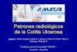Patrones radiológicos de la Colitis Ulcerosa - SORDIC …congreso.sordic.org.ar/uploads/2017/poster/2017_420_PE_Abdomen.pdf · La colitis ulcerosa (CU) es una enfermedad inflamatoria