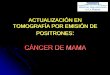 CÁNCER DE MAMA en cancer de mama.Tembl.pdf · 2015-04-18 · TOMOGRAFÍA POR EMISIÓN DE POSITRONES: CÁNCER DE MAMA. Declaración de conflicto de intereses El autor declara no conocer