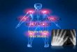 ARTRITIS DEFORMÁTICA REUMATOIDE - anpronep.organpronep.org/articulos/artritis-deformatica-reumatoide.pdf · años en el tratamiento de la Artritis reumatoidea, y en ... aplican al