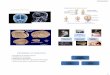 27/04/2017 - ecaths1.s3.amazonaws.comecaths1.s3.amazonaws.com/fbpe/1511308263.SISTEMA NERVIOSO.pdf · Estructura Blanquecina situada dentro del canal vertebral. ... •TALLO CEREBRAL