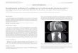 Braquiterapia endoluminal esofágica en el tratamiento del ...scielo.isciii.es/pdf/diges/v107n7/es_nota2.pdf · Braquiterapia endoluminal esofágica en el tratamiento del cáncer