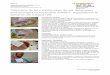 Tratamiento de las complicaciones de una dehiscencia … · Clínico, Div. Curación de Heridas, Smith & Nephew, S.A. Tratamiento de las complicaciones de una dehiscencia post-quirúrgica