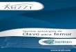 Técnica quirúrgica de Clavo para femur - ARZZTarzzt.com/pdf/cif.pdf · canalado, de material de acero o titanio con dos orificios para bloqueo fijo distal y dos para bloqueo proximal,