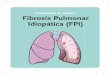 Comprenda su cuerpo Fibrosis Pulmonar Idiopática (FPI) · La denominación Fibrosis Pulmonar Idiopática (FPI) ... La concentración de oxígeno en su sangre se puede medir con un
