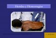 Heridas y Hemorragias - ceaer.edu.arceaer.edu.ar/wp-content/uploads/2018/04/Heridashemorragias.pdf · Actuación general ante heridas ... permitir la transpiración, costuras planas