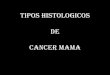 TIPOS HISTOLOGICOS DEL CANCER MAMA - seom.org · predominan los receptores de hormonas positivos, los llamados luminales (los más ... 70 % GRADO DEPENDIENTE ( NO TIPO HISTOLOGICO
