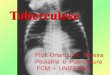 Tuberculose - Orlando A.· Tuberculose Primária p Tuberculose pós ... extrapulmonar (exceto meningite)