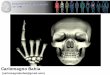 Apresentação do PowerPoint - anatomia.icb.ufrj.branatomia.icb.ufrj.br/material/09A_EduFis_CranioCarlomagno.pdf · Neurocrânio – ossos realcionados ao encéfalo. Viscerocrânio