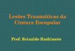 Lesões Traumáticas da Cintura Escapular · Lesões Traumáticas da Cintura Escapular Prof. Reinaldo Hashimoto. Anatomia •Articulações •Óssea •Nervos •Vasos. Articulação