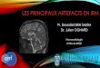 ARTEFACTS en IRM - cerf.radiologie.fr · Rapport Signal/Bruit (S/B) trop faible La répartition du bruit est homogène sur l’image Patient (agitation thermique des protons à l’origine