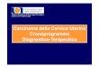 Carcinoma della Cervice Uterina Cronoprogramma Diagnostico ... · Carcinoma della Cervice Uterina Cronoprogramma Diagnostico-Terapeutico Struttura Complessa di Ginecologia Oncologica