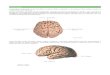 jorgebio.webnode.com.br · Web viewEm corte sagital do cérebro, podemos identificar as divisões do corpo caloso: uma lâmina branca arqueada dorsalmente, o tronco do corpo caloso,