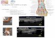 Ecografía del tobillo y el pie. Tendón de Aquiles · Ecografía del tobillo y el pie. Tobillo Ligamento deltoideo Fascículo tibio-astragalino del ligamento deltoideo Fascículo