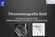 Neurosonografía fetal - CERPO · Neurosonografía fetal Dra Susana Aguilera Peña CERPO, Facultad de Medicina, U de Chile, CLC