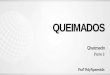 QUEIMADOS - qcon-assets-production.s3.amazonaws.com · Regra dos 9 • Áreas nobres / queimaduras especiais: Ocular, Auricular, face, pescoço, mão, pé, região inguinal, grandes