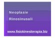 rinosinusali - fisiokinesiterapia.biz · Carcinoma squamoso Istotipo più comune (80%) Mascellare > fossa nasale > etmoide ... istologicamente simile all’adenocarcinoma del colon