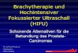 Brachytherapie und Hochintensiver Fokussierter Ultraschall ... · Brachytherapie und Hochintensiver Fokussierter Ultraschall (HIFU) Schonende Alternativen für die Behandlung des