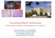 MYELOPROLİFERATİF HASTALIKLAR - patoloji2017.orgpatoloji2017.org/wp-content/uploads/2017/12/3.-İBRAHİM-HAZNEDARO... · Trombositopeni % 0 •Subklinik DİK (D-dimer yüksekliği