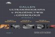 POŁOŻNICTWIE - edraurban.pl · Tytuł oryginału: Callen’s Ultrasonography in Obstetrics and Gynecology 6th edition This edition of Chapters 1-8, 38 and Appendices A-D of Callen’s