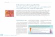 Glomerulonephritis - urologen-infoportal.deurologen-infoportal.de/urologie/uro_infekt/print/glomerulum.pdf · Syndroms und einem (akut) ne-phritischen Verlauf unterschie-den (Tabelle)
