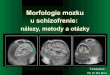 Morfologie mozku u schizofrenie - Psychiatrie FN Brno: ÚVODpsychiatrie.med.muni.cz/res/file/tk/sch_morfo_HK09.pdf · Neuropatologie II – od 1990 Neuropatologie opět centrem zájmu