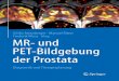 MR- und PET-Bildgebung der Prostata - download.e-bookshelf.de · Klinik für Urologie, Universitätsmedizin Mannheim, Med. Fakultät Mannheim der Universität Heidelberg, Mannheim