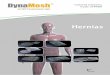 Hernias - de.dyna-mesh.com ·  7 by FEG Textiltechnik mbH Todo para el médico Nuestra gama incluye implantes fabricados a medida para la cirugía moderna de hernias y estomas