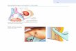 Farbabbildungen zu Kapitel 1: Chirurgie978-3-540-46336-8/1.pdf · Hemikolektomie 81, 94 Hemithyreodektomie 63, 64 Hepatikojejunostomie 110 Hepatikolithiasis 108 Hepatocholedochus-Resektion