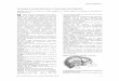 TOPOGRAFÍA CRANEOENCEFÁLICA Y ANATOMÍA DE SUPERFICIEhandbook.usfx.bo/nueva/vicerrectorado/citas/TECNOLOGICAS_20/Topografia/... · TÉCNICA’QUIRÚRGICA’ Rev. Neurociencias Vol